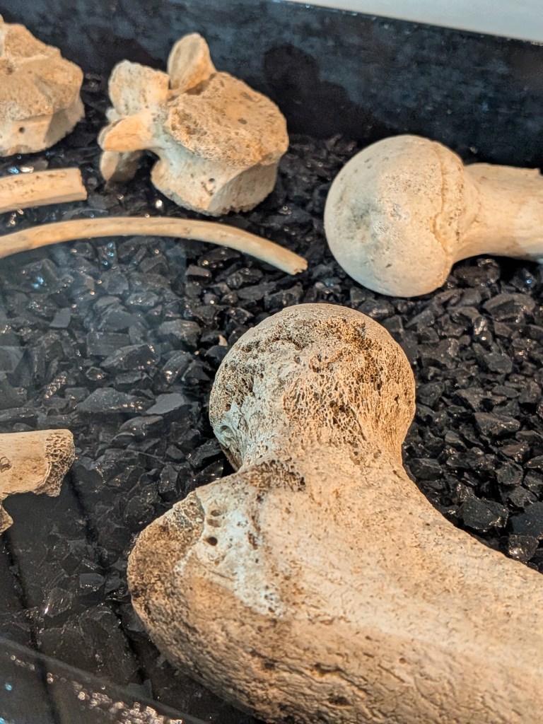 The femur of a young man. Part of a skeleton found at the bottom of a well in a Romano-British villa. His story is unknown, lost to the lacunae. From Brading Roman Villa, Isle of Wight, UK.